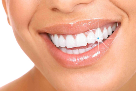 Cosmmetic-Dentistry_teeth-jewellery